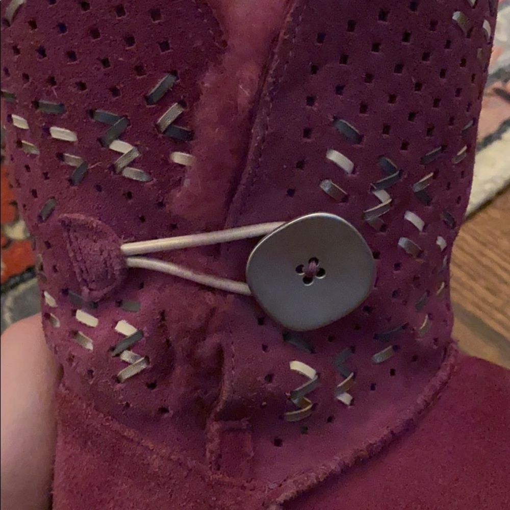 Ugg Bailey Button Winter Boot - image 4